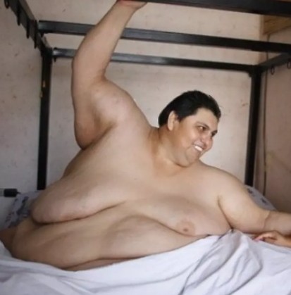 La obesidad roba el sueño… y el oxígeno